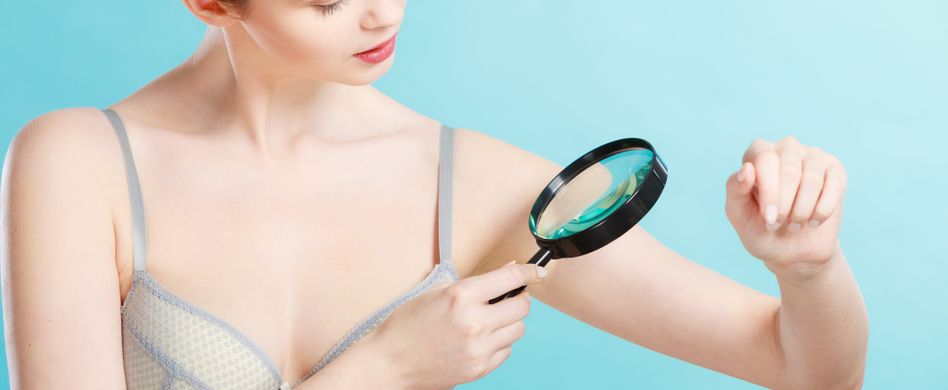 5 Fakten zu schwarzem und weißem Hautkrebs