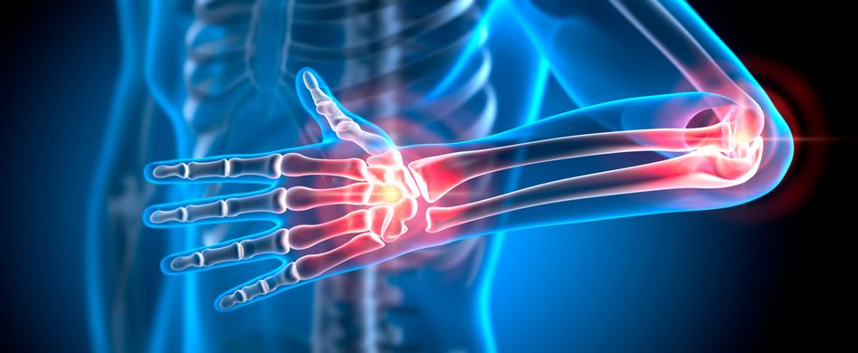 blaues 3d bild von menschlichem körper mit rot markierten stellen an gelenken im arm