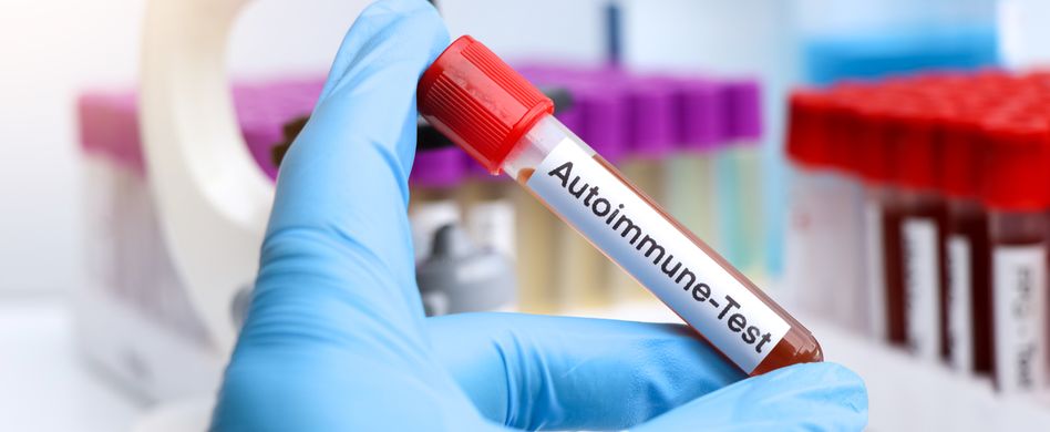 Autoimmunkrankheiten: Wenn der Körper sich selbst angreift