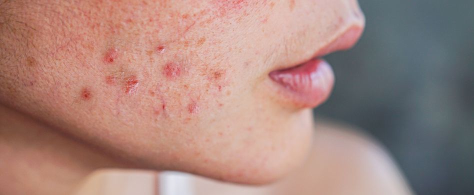 Physische Veränderungen während der Pubertät: So verändert sich dein Körper