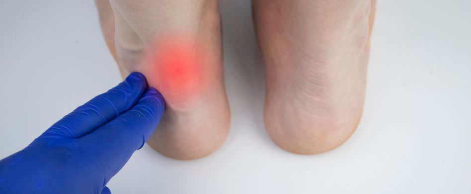 arzt schaut verletzte achillessehne von patient an