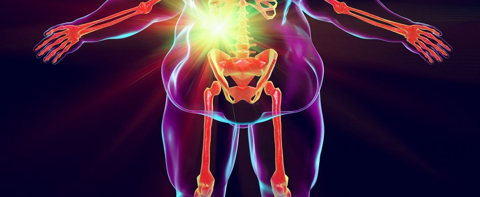 animiertes bild von mann mit übergewicht und gallenleiden