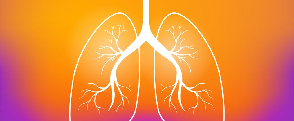 graphik von lunge