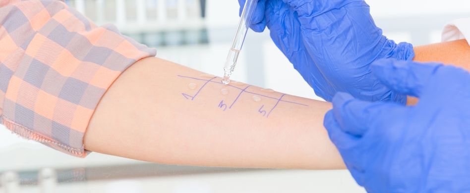 Allergie-Diagnose: Diese Allergietests stehen dem Arzt zur Verfügung