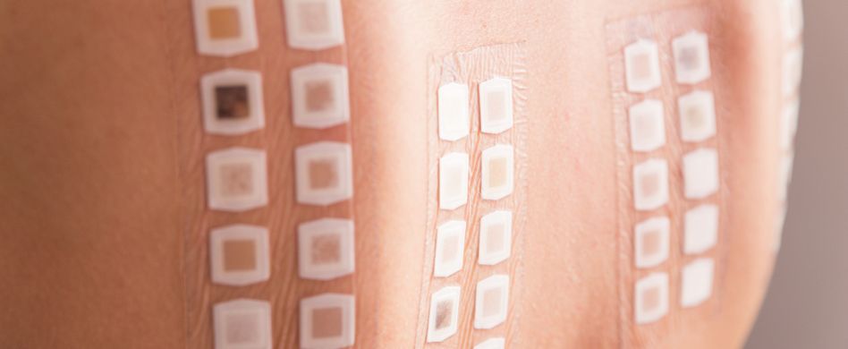 Allergien: 5 häufige Fragen im Überblick