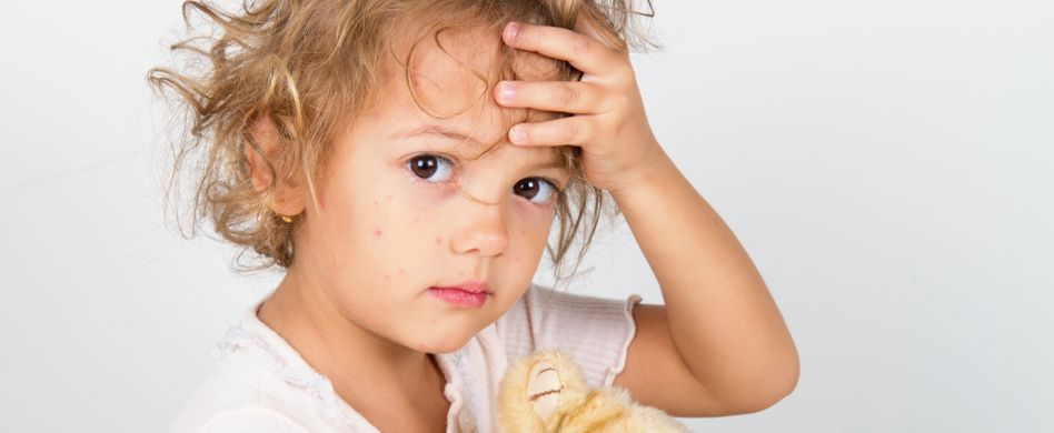 An diesen Symptomen erkennen Sie die Kinderkrankheit