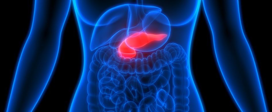 Bauchspeicheldrüsenkrebs: 5 Fakten zum Pankreaskarzinom