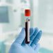 Bluttests zur Krebsfrüherkennung: Kann ein Bluttest Krebs erkennen?