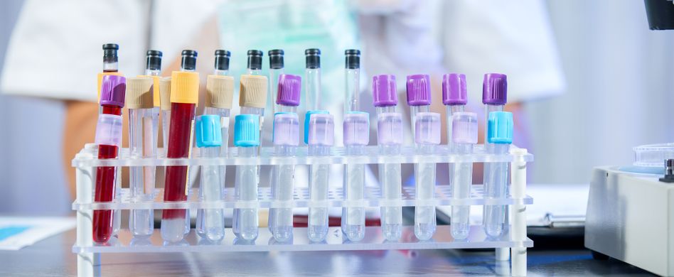 Blutwerte verstehen: Was Glucose Blutwert und Co. bedeuten