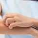 Borreliose durch Mücken: Übertragen die Blutsauger die Krankheit?