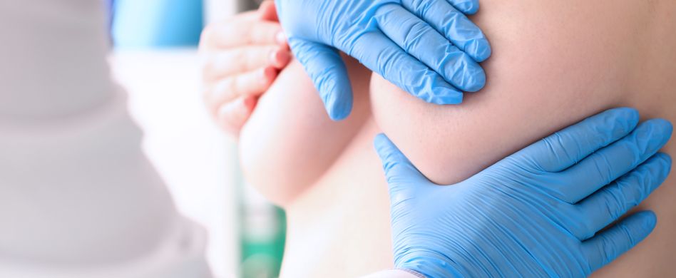 Bruststraffung: Das sollten Sie vorher beachten