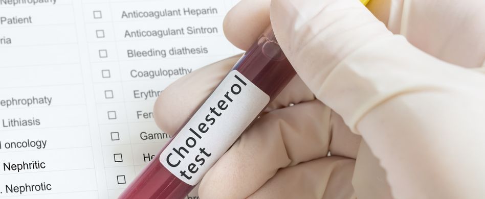 Colesterin Werte: Was die Blutwerte bedeuten und wann sie zu hoch sind