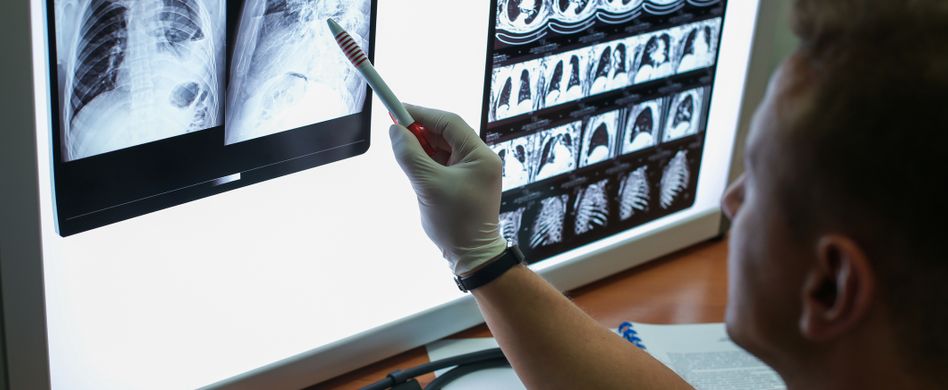 arzt zeigt auf ct und mrt bild der lunge