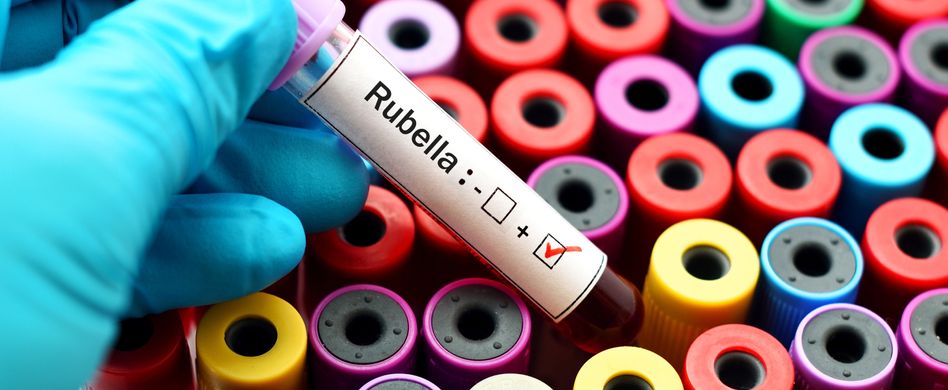 Das sind die Auslöser für Röteln