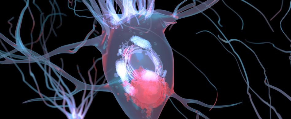 Demenz mit Lewy Körperchen: Ursache, Symptome und Verlauf