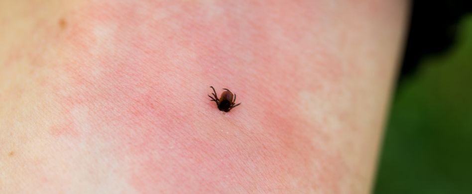 Die Verbreitung von Borreliose