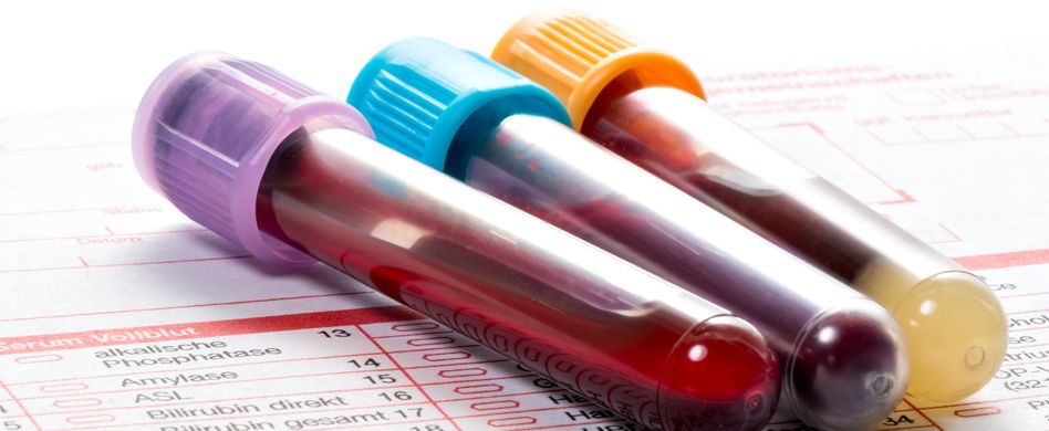 Eisen, Vitamin D und Vitamin B12: Blutuntersuchung bei Verdacht auf einen Nährstoffmangel