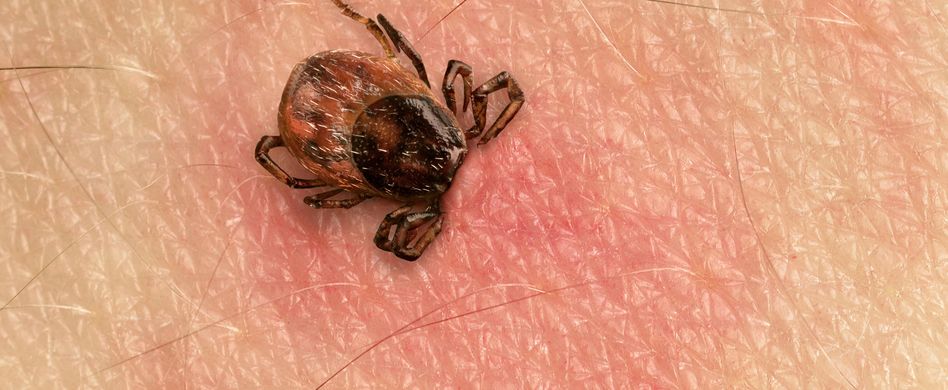 Expertentipps: Was Sie wirklich über Zecken wissen müssen