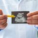 Gallenblasenpolypen: Harmlose Tumoren der Gallenblase