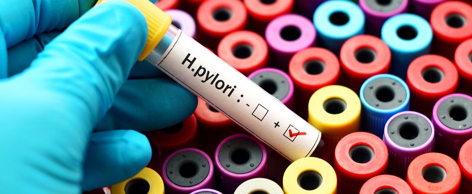 Gastritis kann unterschiedliche Ursachen haben 