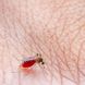 Gefahr in der Schwangerschaft: Das Zika Virus und seine Symptome