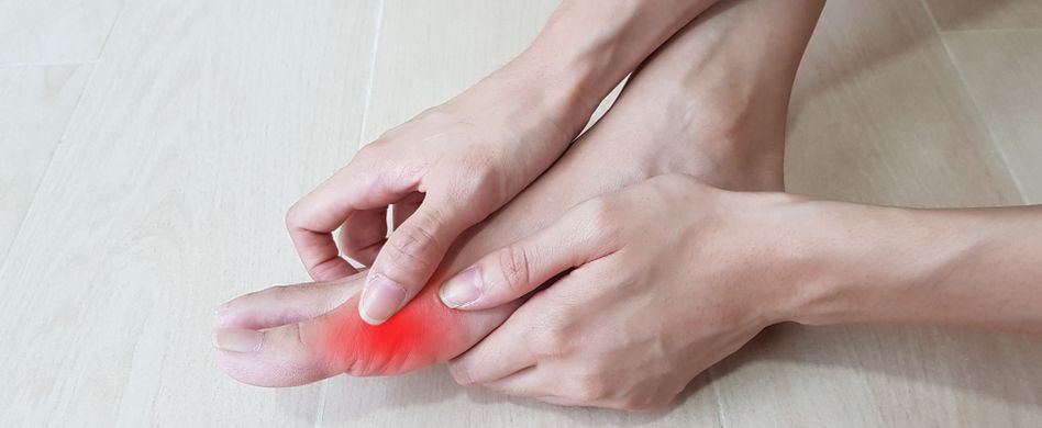 Gicht im Zeh: Was darauf hindeutet und welche Behandlung hilft