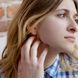Gürtelrose: Herpes zoster behandeln