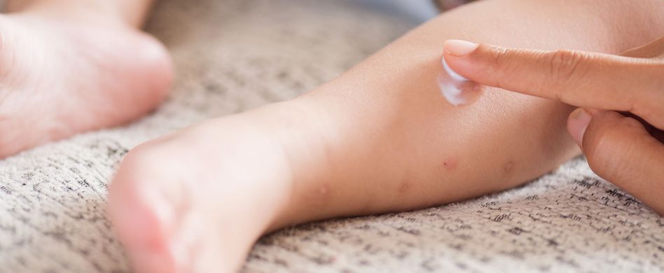 Hand-Fuß-Mund-Krankheit: Ansteckung, Symptome und Behandlung