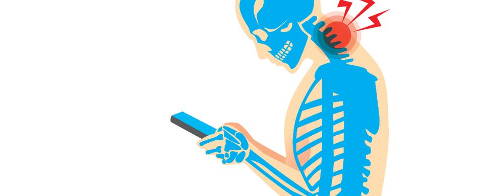 Handynacken: Ursache, Beschwerden und was Sie dagegen tun können