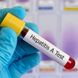 Hepatitis A: Symptome und Ansteckung