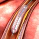 Herzinfarkt behandeln: Stent oder Bypass?