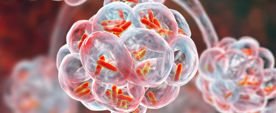 Keuchhusten-Ursache: Warum wir an Keuchhusten erkranken