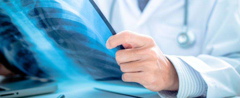 Knochenkrebs: Ursachen, Risikofaktoren und Symptome