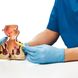 Komplikationsrisiko: Wie gefährlich sind Hämorrhoiden?