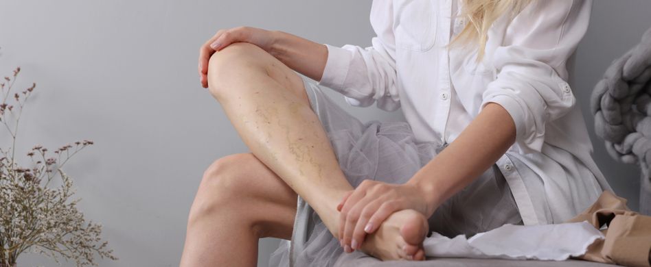 Krampfadern-Symptome: Verursachen Krampfadern Schmerzen?