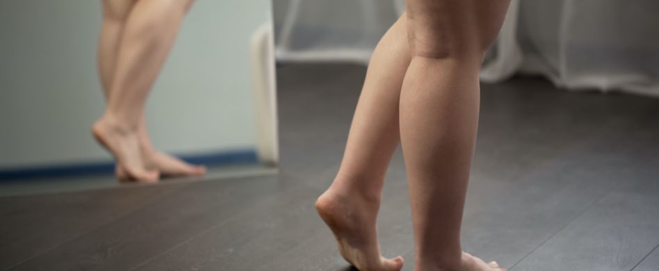 Lipödem: Was ist das?