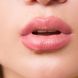 Lippenherpes: Fast jeder hat das Herpes-Virus