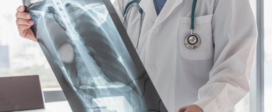 Lunge auf Röntgenbild
