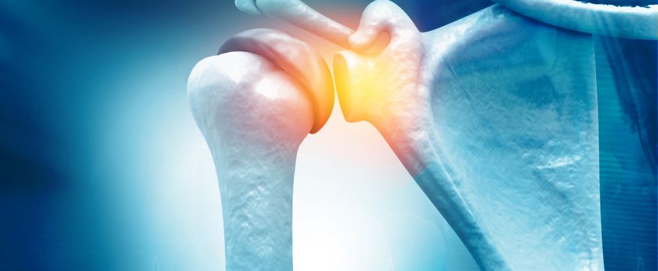 ausgekugelte schulter anatomie