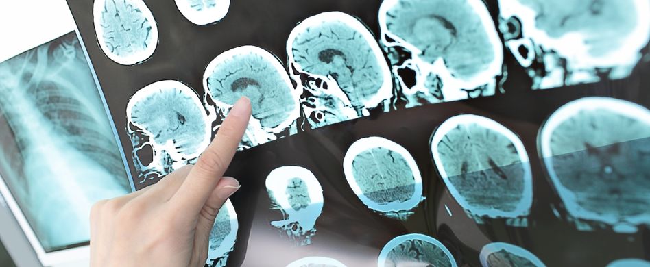 untersuchung von mrt an kopf