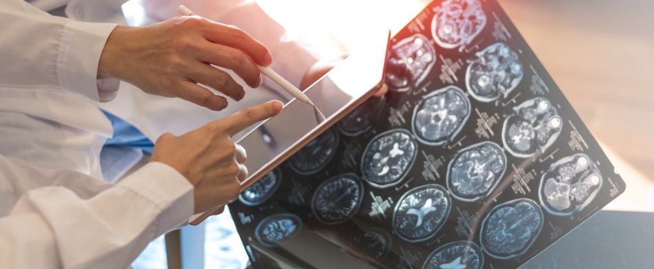 ärzte schauen sich röntgenbild von gehirn an