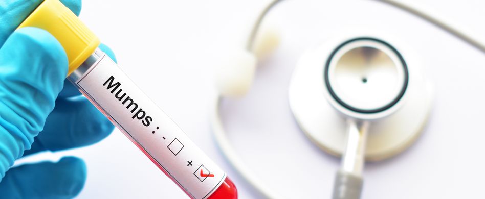 Mumps: Symptome, Behandlung & Mumps-Impfung