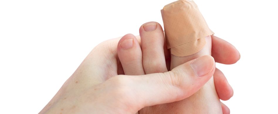 Nagelbettentzündung am Zeh: Wie kann sie behandelt werden?