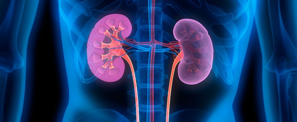 grafik von nierensteinen im körper