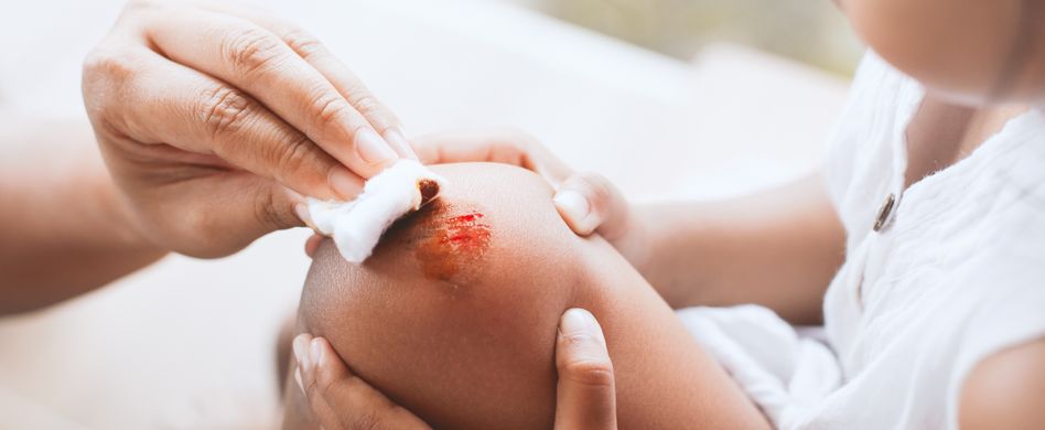 Kind offene Wunde am Knie