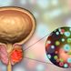 PSA-Test beim Urologen: Gibt er Hinweise auf Prostatakrebs?