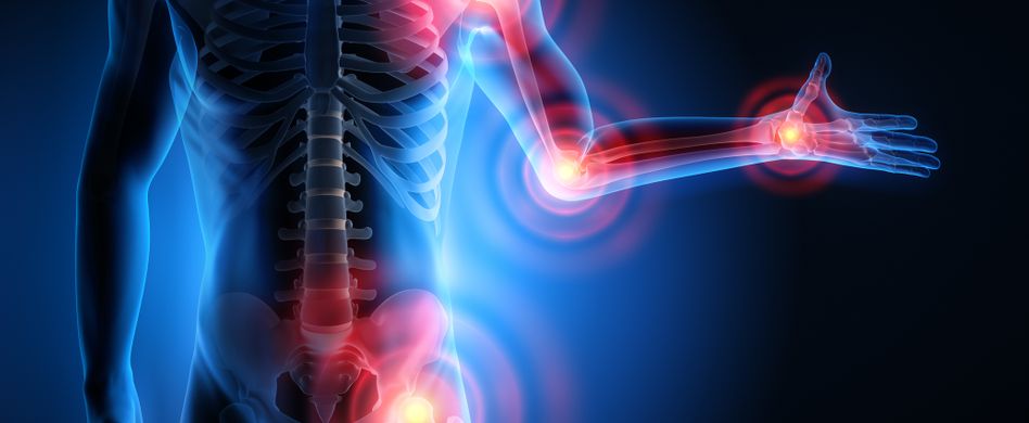 Reaktive Arthritis: Ursachen, Symptome und Behandlung