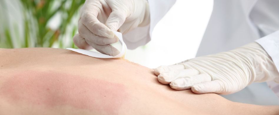 Rückenhaare entfernen: Mit Wachs, Rasur oder Laser?