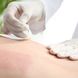 Rückenhaare entfernen: Mit Wachs, Rasur oder Laser?
