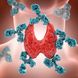 Schilddrüsenerkrankung: Was ist Hashimoto-Thyreoiditis?